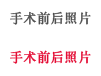 手术前后照片