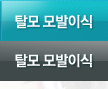 탈모모발이식