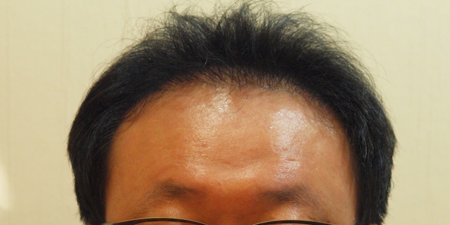 후사진