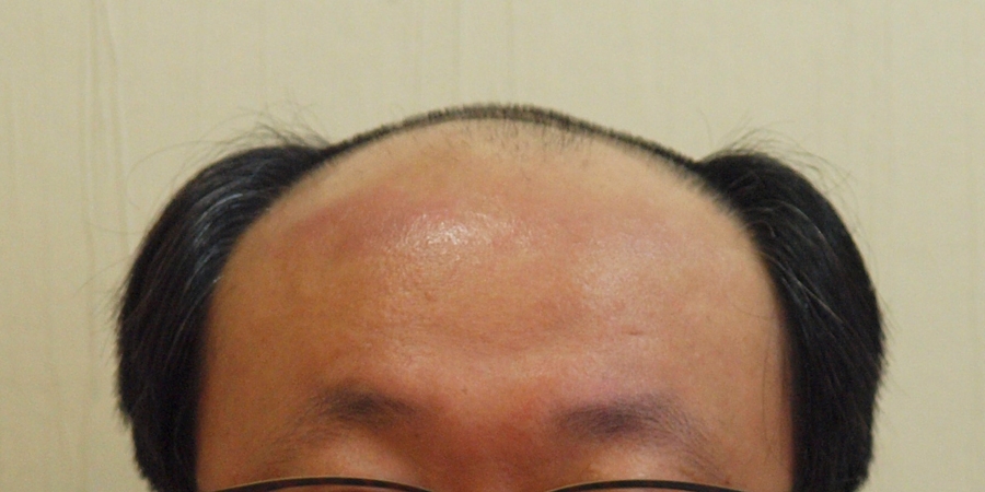 후사진