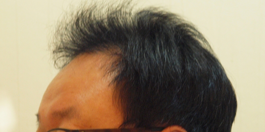 후사진