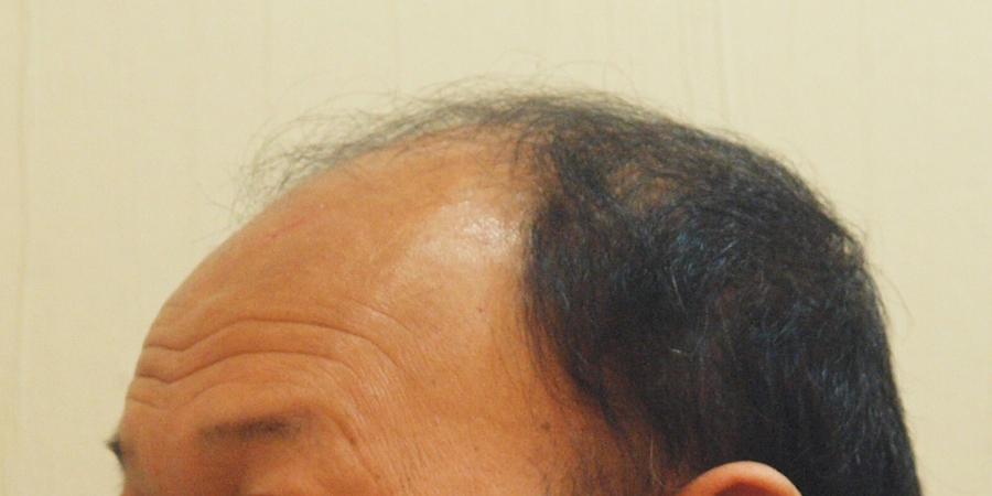 후사진