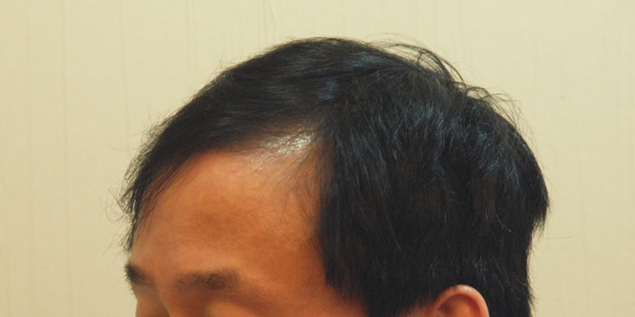후사진