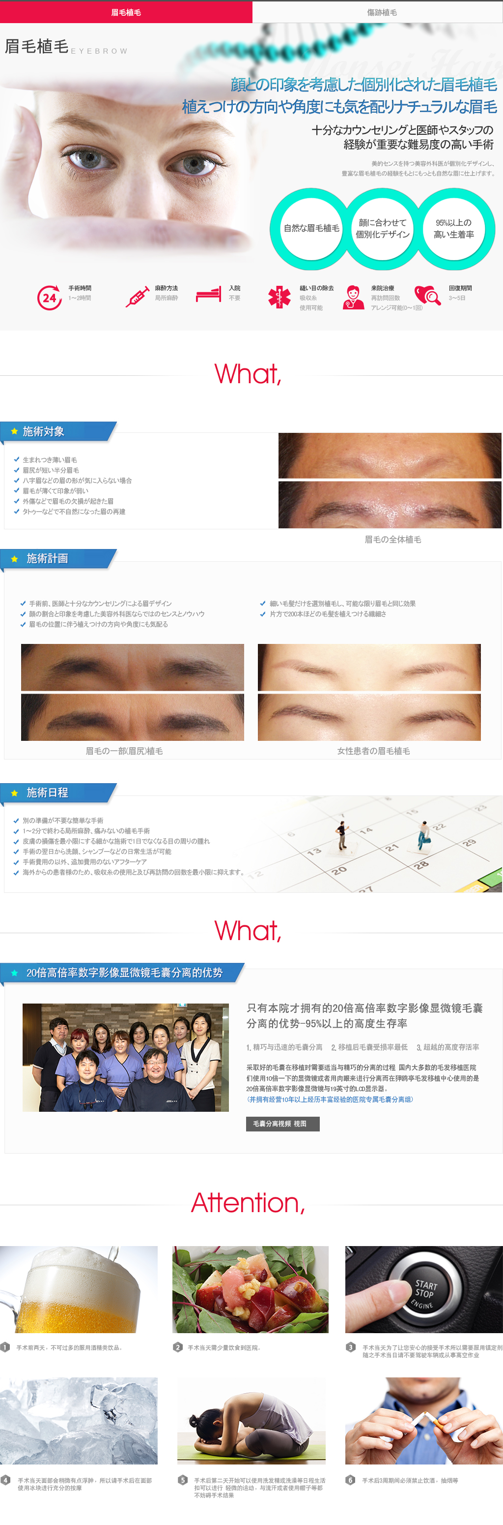 눈썹이식